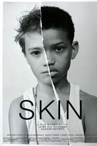 Skin Skin